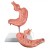 Erler-Zimmer Stomach Anatomy Model with Gastric Band