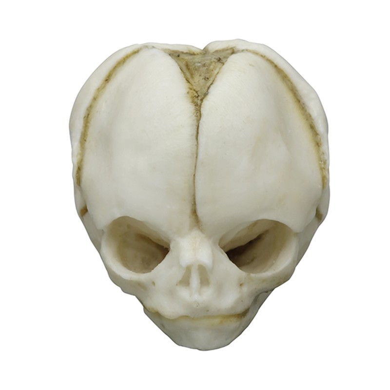 Fetal Skull Models