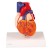 Erler-Zimmer 2-Part Heart Bypass Model