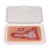 Erler-Zimmer Scalding-Burn Wound Moulage