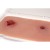 Erler-Zimmer Leg Bullet Wound Moulage with Bleeding Function