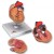Classic Heart Model with Left Ventricular Hypertrophy (2-Part)