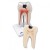 Type of Tooth: Lower Twin-Root Molar (2-Part)