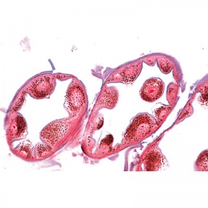 3B Metabolism Microscopic Slides