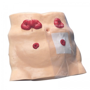 Ostomy Care Model