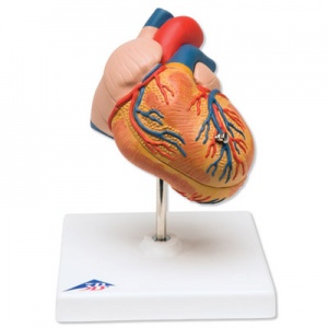 Classic Heart Model with Left Ventricular Hypertrophy (2-Part)