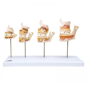 Dentition Development Model