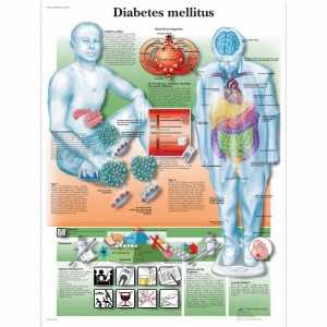 Diabetes Mellitus Chart