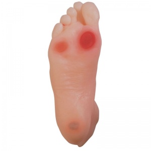 Diabetic Foot Model