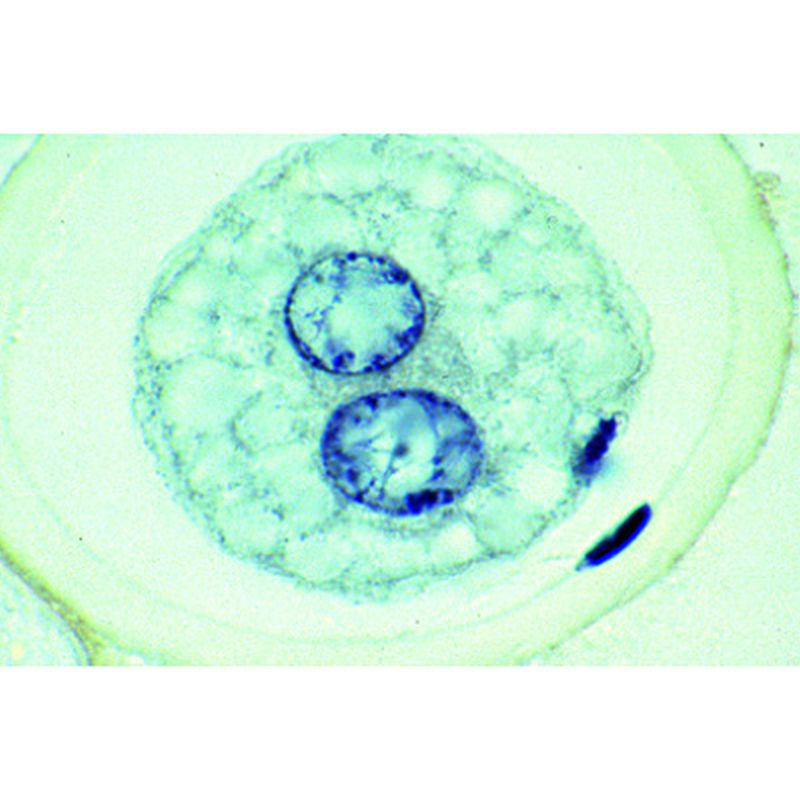 3B Ascaris Megalocephala Embryology Microscopic Slides