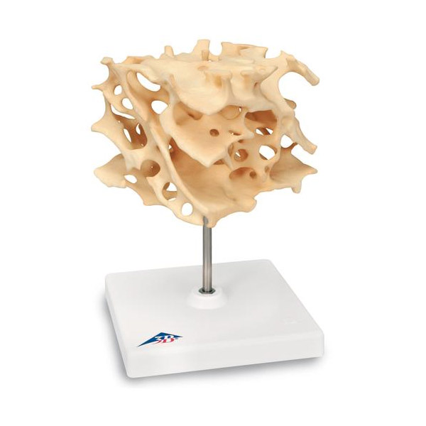 Cancellous Bone Model
