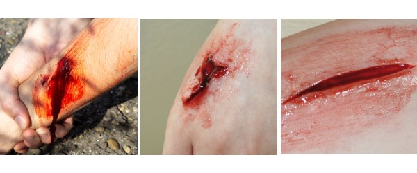 artificial wounds applied to the skin