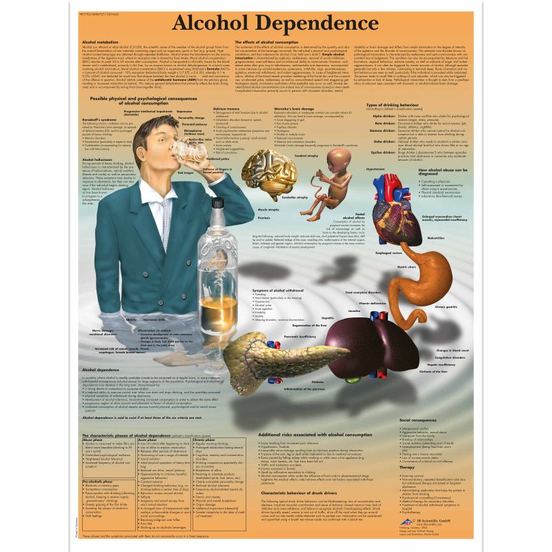 Alcohol Dependence Chart LabWorld.co.uk