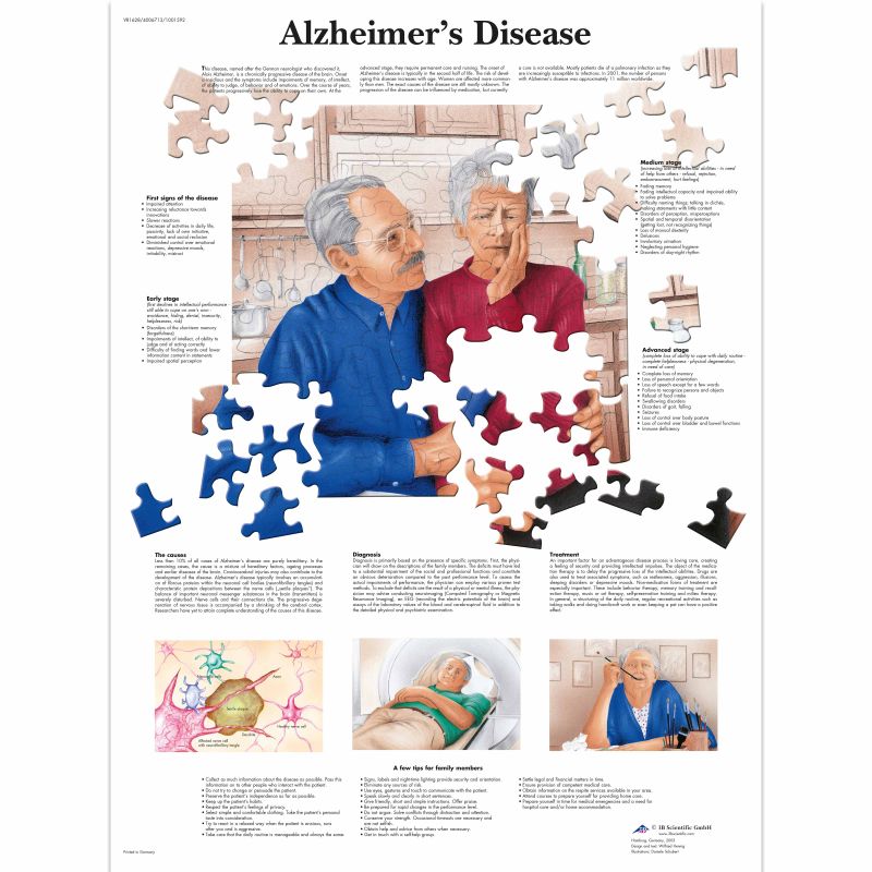 Alzheimer's Disease Chart