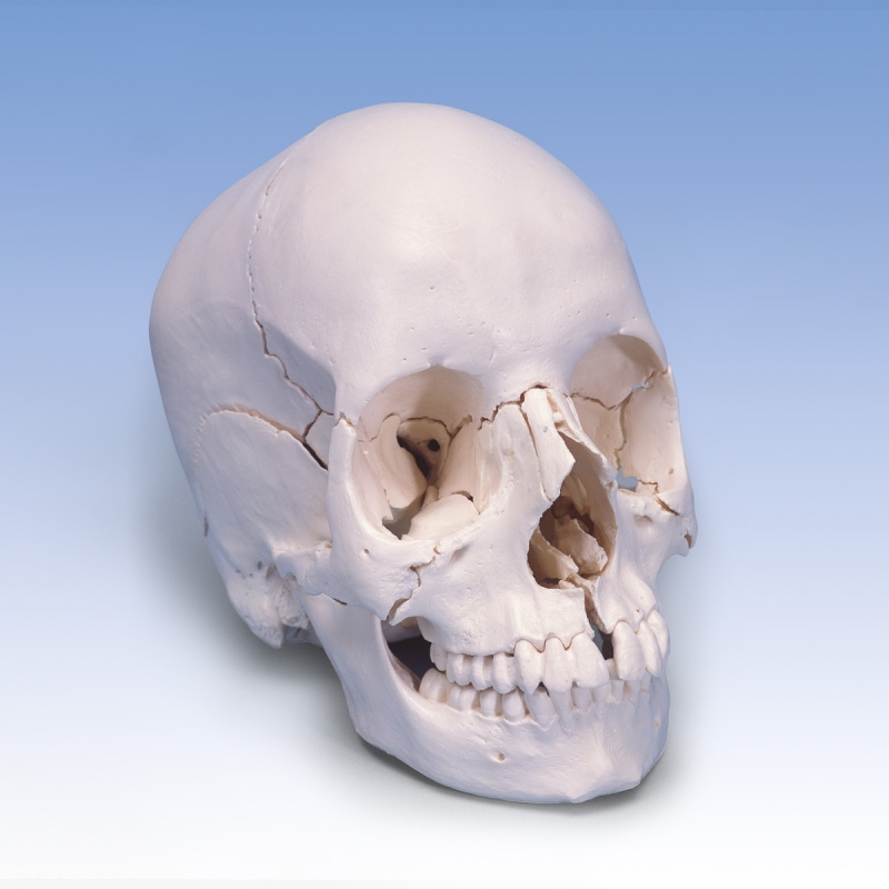 Beauchene Adult Human Skull Model (22-Part)