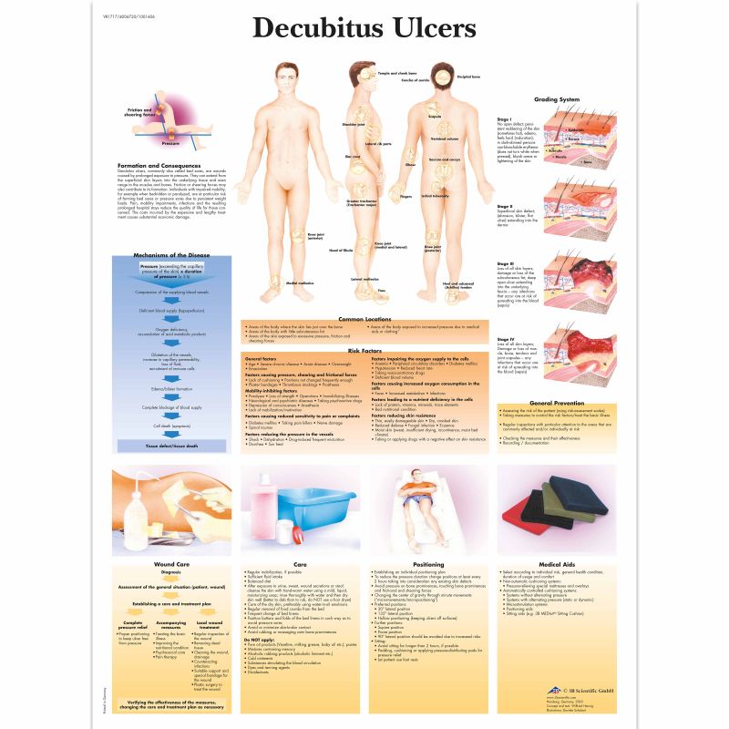 Decubitus Ulcers Chart