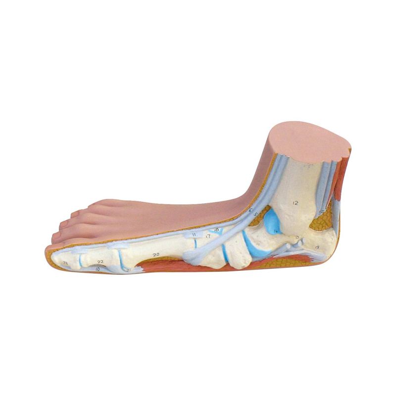 Normal, Hollow and Flat Foot Structure Model - LabWorld.co.uk