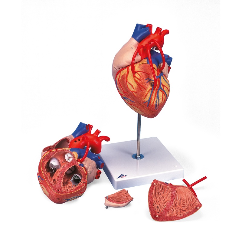 Heart Model with Bypass, 2 Times Life-Size (4-Part)