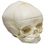 Erler-Zimmer 40-Week Fetal Skull Model with Calvarium Cut