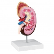 Erler-Zimmer Kidney Model (Twice Life Size)