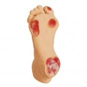 Erler-Zimmer Elderly Pressure Ulcer Foot Model