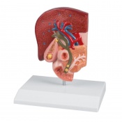 Erler-Zimmer Biliary System Gallbladder Model (With Gallstones)