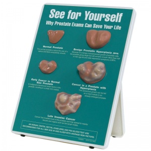Why Prostate Exams Can Save Your Life Easel Display